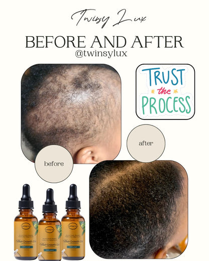 Twinsy Lux Hair Growth Oil Rosemary Mint Nourishing Scalp & strengthening density 100% pure plant Hair oil treatment for all Hair type