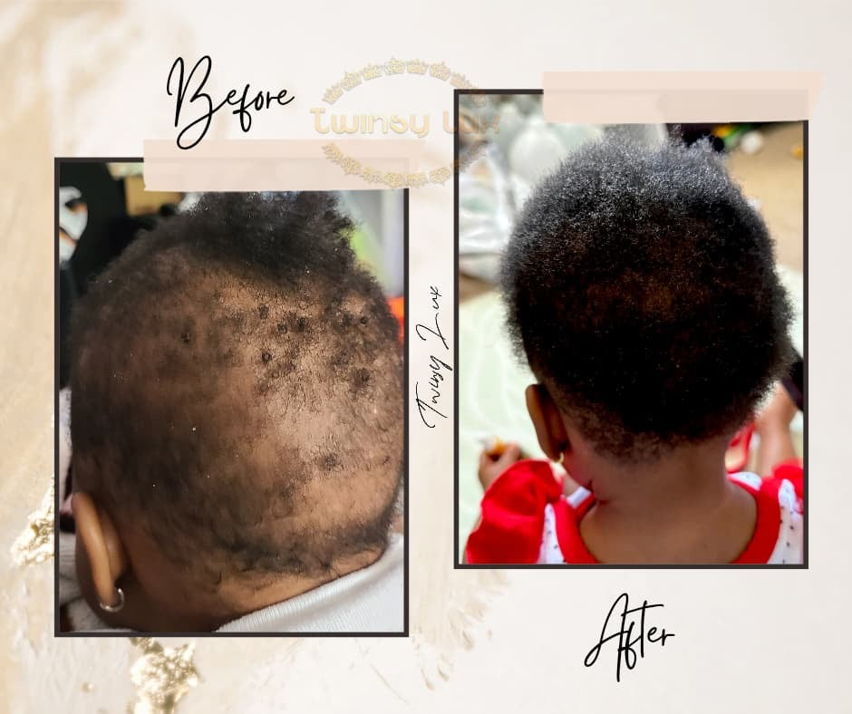 Twinsy Lux Hair Growth Oil Rosemary Mint Nourishing Scalp & strengthening density 100% pure plant Hair oil treatment for all Hair type