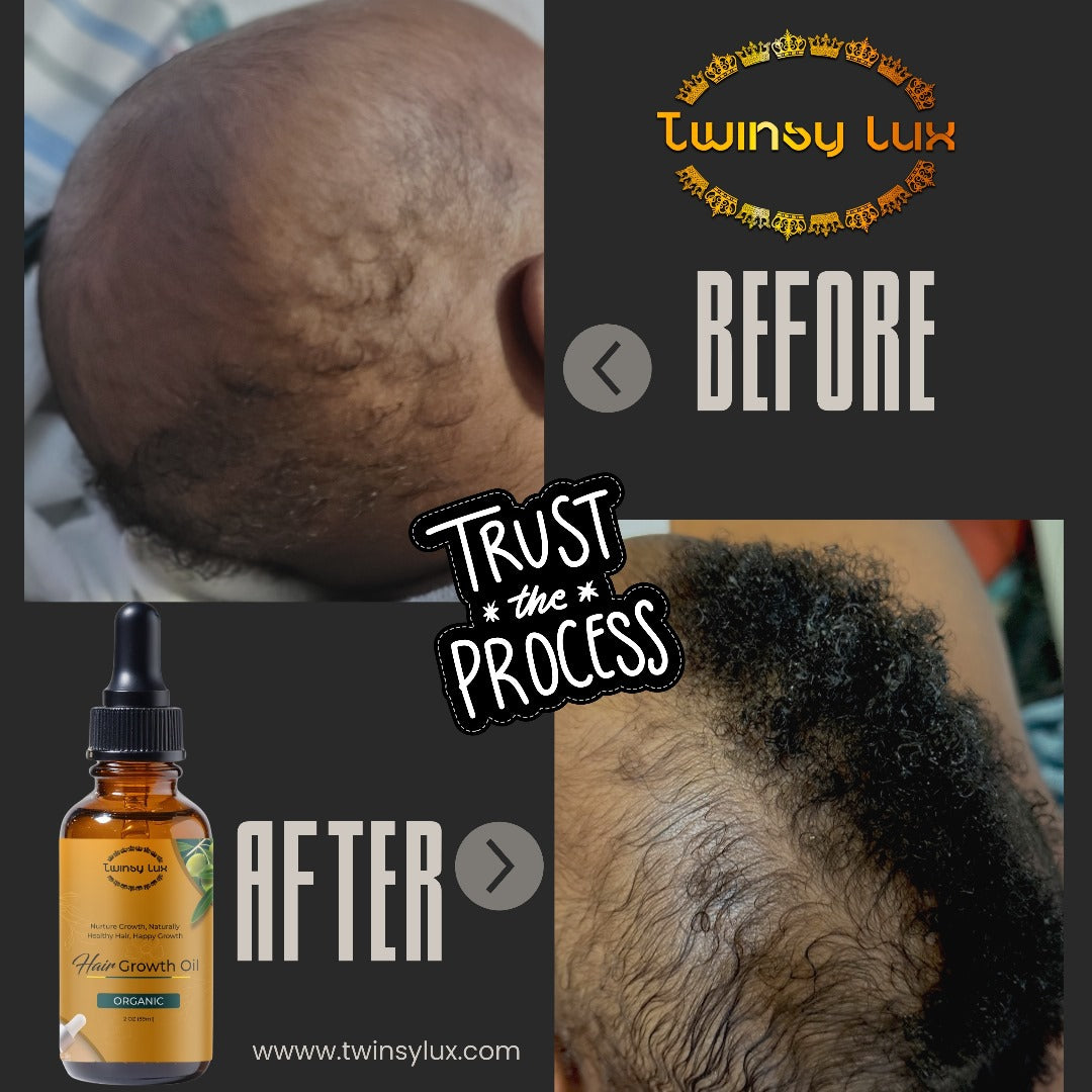Twinsy Lux Hair Growth Oil Rosemary Mint Nourishing Scalp & strengthening density 100% pure plant Hair oil treatment for all Hair type